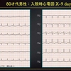 ECG-301：80才代男性。夜間の頻脈発作です。