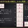 ECG-234：answer