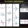 ECG-274：answer