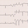 ECG-149：answer