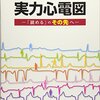 心電図の勉強、50日目。～洞房ブロック～