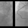 ECG-063：answer