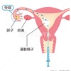 人工授精は意味が無い？