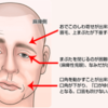 口角挙上試験の方法と見方
