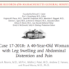 Case 17-2018: A 40-Year-Old Woman with Leg Swelling and Abdominal Distention and Pain