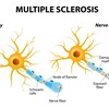 Multiple Sclerosis: Exactly What You Need To Have To Understand