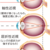 近視進行を抑える！！