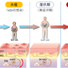 帯状疱疹の症状