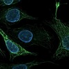 生気論が復帰しつつあるのか？