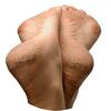 Ball Of Foot Pain (Metatarsalgia)
