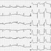 ECG-099：E098の一週間後の出来事です。