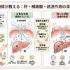 肝の疏泄作用と「横隔膜」の関係　/　