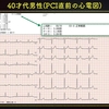 ECG-216：answer(2/2)