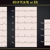 ECG-254：80才代女性。座位での意識障害です。