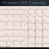 ECG-150：answer