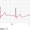 iPhoneで健康管理（心電図，体温）