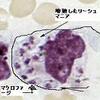 ウイルスに感染したリーシュマニアが協力して免疫細胞を破壊する