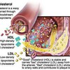 Petunjuk Lower LDL Kolesterol - 5 Rahasia Ultimate Kesehatan Jantung
