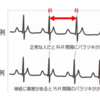 糖尿病でCVRRが低下する理由