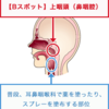 No25　治療師ドウシタの「Bスポット治療体験記」　～モニター患者様募集情報あり～