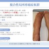 慢性難治性疼痛に対する脊髄刺激療法を科学する３