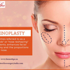 Rhinoplasty Surgery: WHY , HOW and WHERE