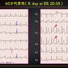 ECG-284：answer(1/2)