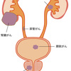 腎臓がん寛解までの道のり(3)