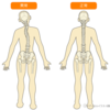 「体のゆがみ」が、腰痛の原因になる！？ 