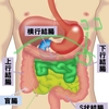 喉を通らない感情抑圧