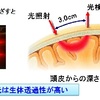 うつはヘモグロビンで分かる？！