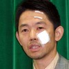 痛いニュース(ﾉ∀`):赤城農相　閣議後の記者会見に、顔に謎の傷を負って登場　理由も“非公開” 