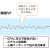 VT/VFを調べてみた①