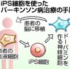 ｉＰＳでパーキンソン病治療へ、京大が臨床申請