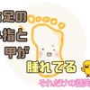 右足の小指のつけ根から甲が腫れてる話