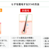 【メンズヒゲ脱毛】青ヒゲの心配はもうおしまい