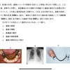 113回全部床義歯振り返り　誤嚥編