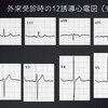 ECG-155：58才男性。夜間・安静時の胸痛発作で来院。