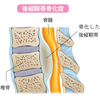 MRI撮影の診断結果を待つ