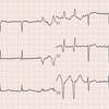 ECG-149：answer