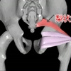 梨状筋症候群