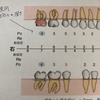 電動歯ブラシ ソニッケアーで歯周病がちょっと改善した話🦷