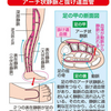 足の甲が痒く、脛の横に脂肪腫？