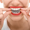 Niềng răng invisalign tại nha khoa đăng lưu