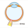 緑内障とは