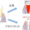 親知らずの抜歯は痛いのか