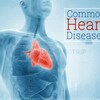 Most Common Types of Heart Diseases