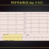 ECG-259：answer