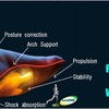 Working with Mortons Neuroma