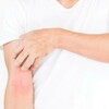 【実体験】アトピー性皮膚炎が肘の内側.膝の裏.首や脇に出やすい理由を経験から予測